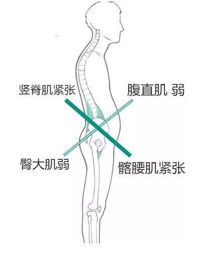 肌肉的形态是天生就已经决定的了,肌肉形态不对称