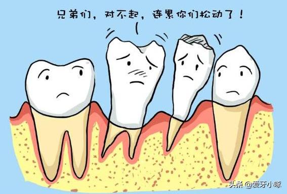 牙周病不能治好的吗,牙周病不治疗后果