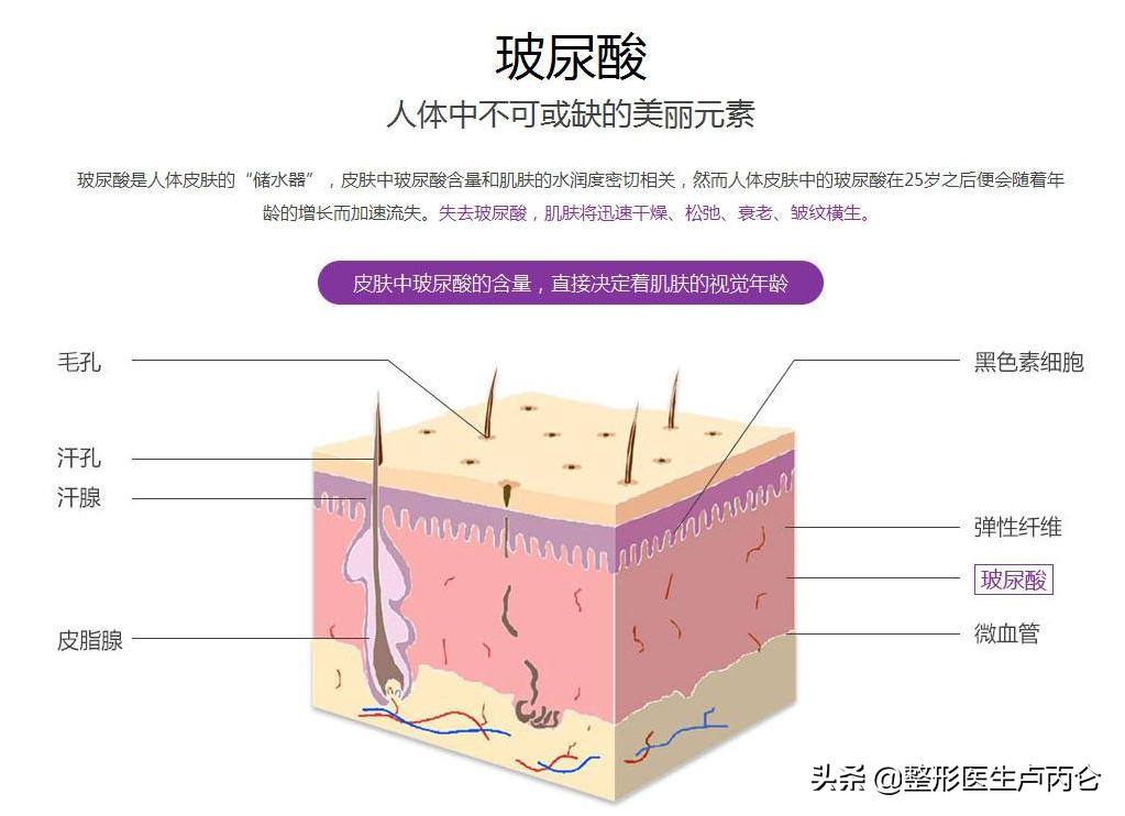 微整形玻尿酸操作流程 (玻尿酸微整形是哪个国家兴起的)