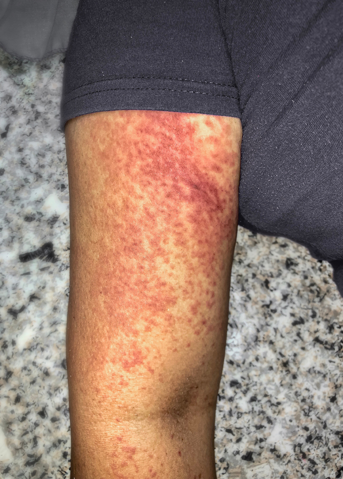 提醒这些网红常用药暗藏风险,止疼药不能乱用科普