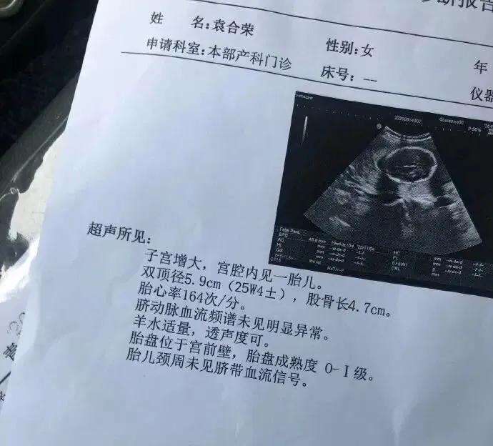 全身肌肉的白衣天使,因模仿“不知火舞”走红,孕期仍坚持健身?