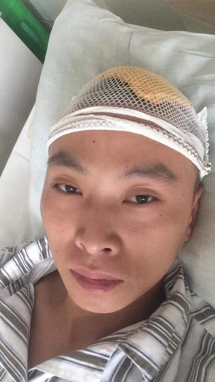 脑胶质瘤真的不能完全治愈吗？