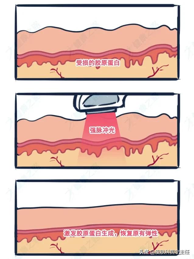 第一次做医美怎么选择机构,第一次做医美选择水光针