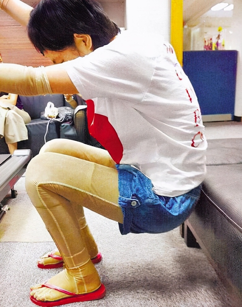 任家萱讲述烧伤经历,任家萱烧伤完整赔偿