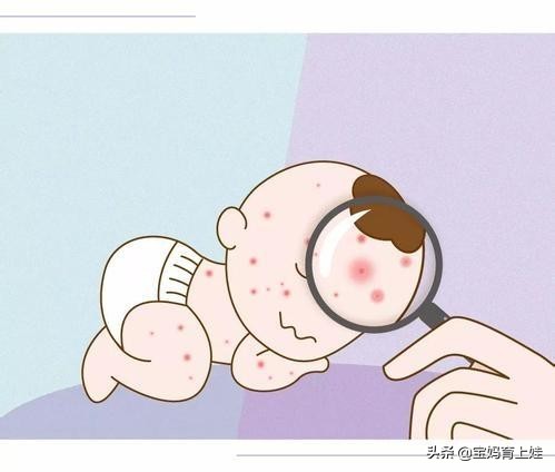宝宝身上起红色硬疙瘩是怎么回事,宝宝身上起红色小疹子是什么原因