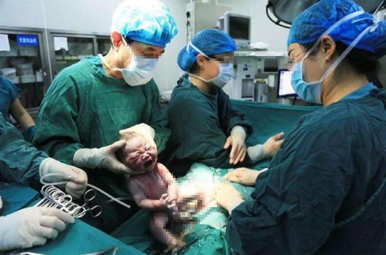 产妇肚子疼想大便但是拉不出来,顺产宫缩想拉屎怎么办