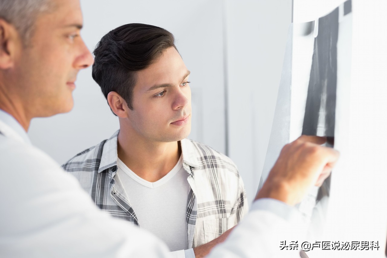 警惕前列腺癌这几点不容忽视,前列腺警惕非良性病变