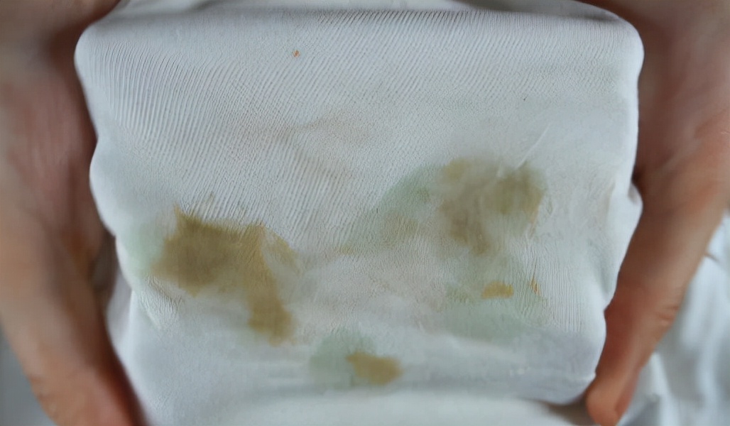 衣服上有油渍怎么洗才干净快速,怎样去除衣服上的机油油渍