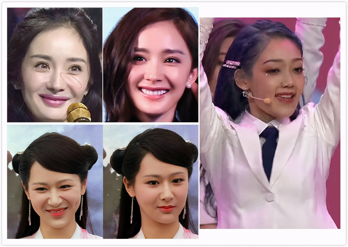 不用十级美颜也能P走法令纹，早知道就好了