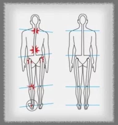 久坐跷二郎腿会使屁股变大么,跷二郎腿正在毁掉你3招帮你纠正