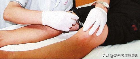 康复理疗馆的经营项目,康复理疗放血疗法