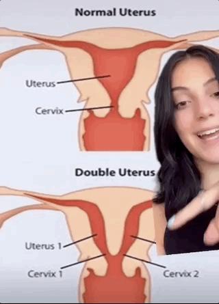 18岁女孩每隔十天又流血,18岁女孩一个月月经来二次