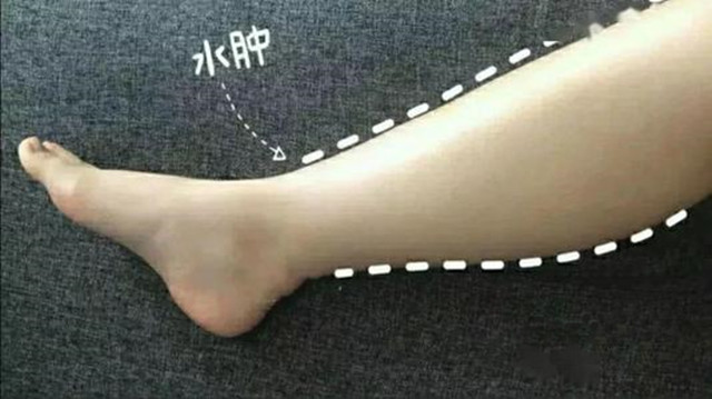 人不胖胳膊粗怎么穿搭,又短又粗的腿穿搭技巧