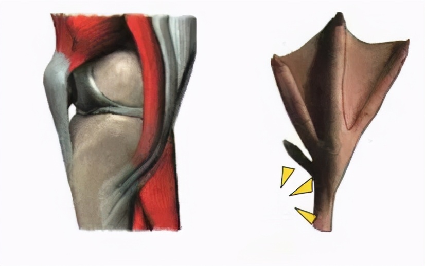 膝关节疼引起的跟腱炎,膝关节痛门诊主诉