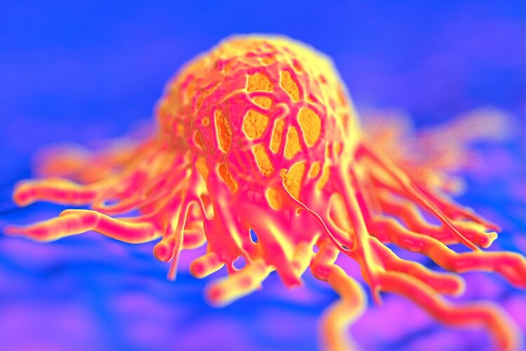 耳鸣也是一种警报,耳鸣意味着你可能得了这些病