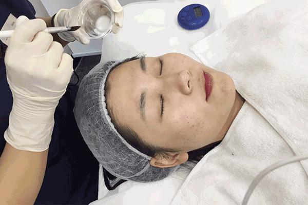 该怎样从源头上改善成人痘印痘坑,祛红痘印黑痘印医美