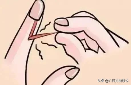 一元钱的红霉素软膏功能这么多,白云山红霉素软膏为什么这么贵