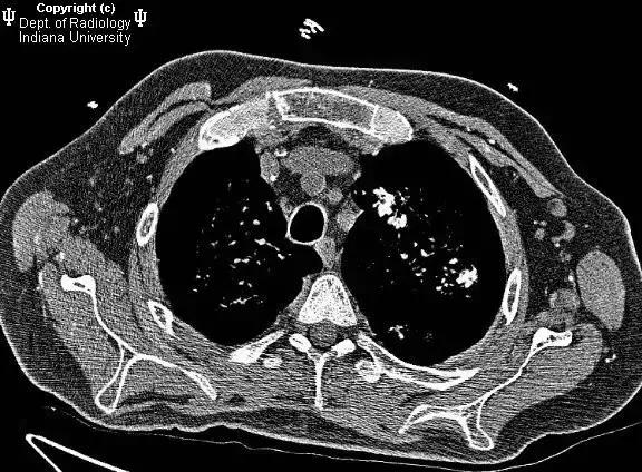 拍了片子拿到结果看不明白？彩虹医生教您看懂影像报告