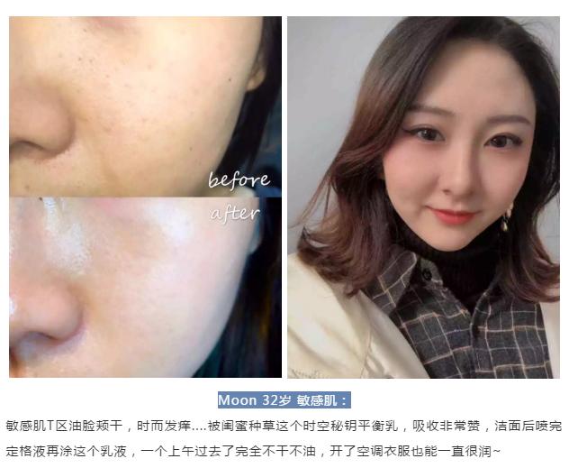 抗老修护黑科技,抗老冻龄18岁