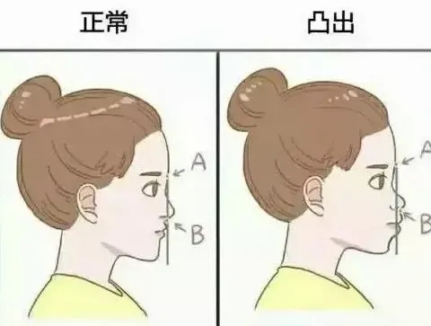 蔡徐坤整牙前后对比图片,蔡徐坤整牙前图片