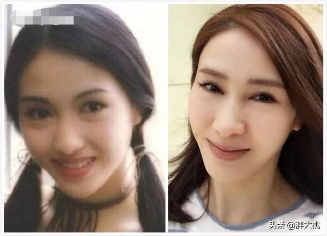 萧亚轩是不是打了玻尿酸一眼便知，明星没有玻尿酸会怎么样？