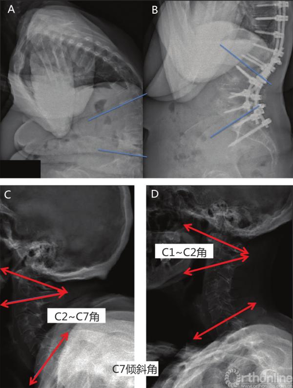 人体平衡分析,健身气功脊柱平衡整套教学视频