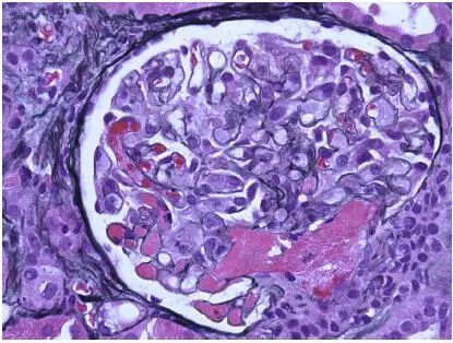 肾毒性食物一览表,肾毒性的药物排名