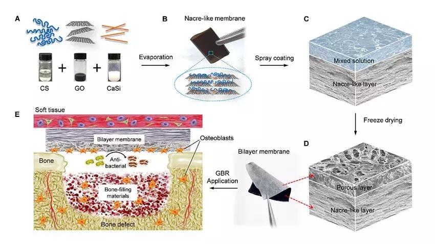 上海交大：用于引导骨再生的新型仿生多功能双层纳米复合膜材料