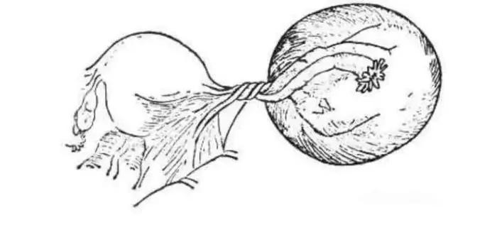 10岁女童经常腹痛是怎么回事,10岁女童腹痛医生一查吓坏了