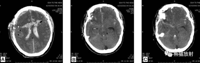 值夜班需要注意什么身体健康,值夜班的十大危害