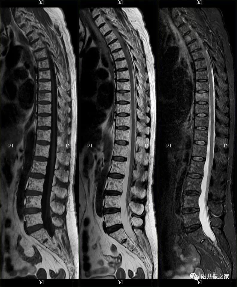 腰椎有哪些病变,腰椎病变有几种