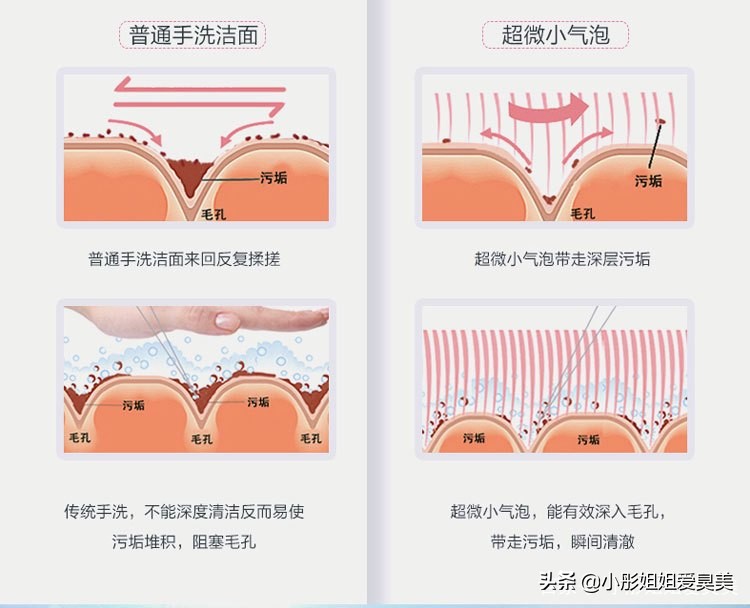 自发泡清洁黑头粉刺小气泡面膜,小气泡去黑头粉刺清洁神器好不好