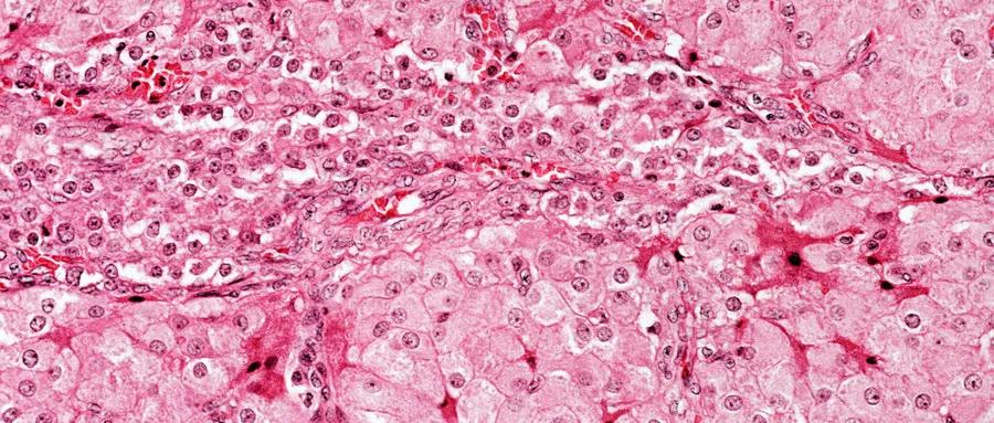 月经到期没来，难道是...