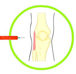 怎么走路才能缓解膝盖的疼痛,走路多了膝盖疼怎么康复锻炼