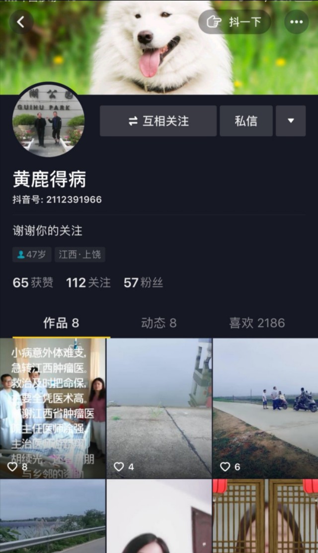 介入止血栓塞术发烧8天了正常吗,介入栓塞术止血