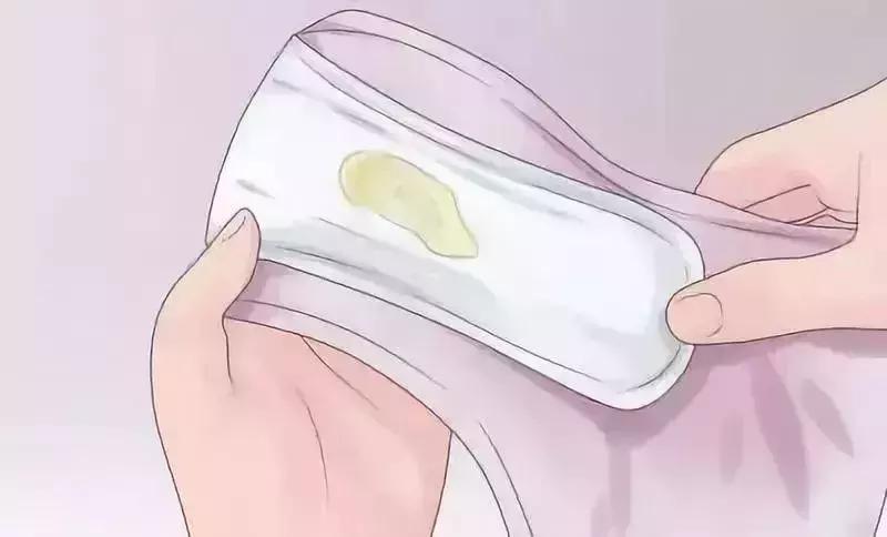 内裤的分泌物什么样是正常,短裤上有黄色的分泌物怎么办