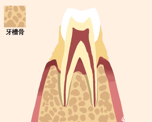 牙齿松动感觉要掉了还能怎么拯救,牙齿松动最佳补救要花多少钱