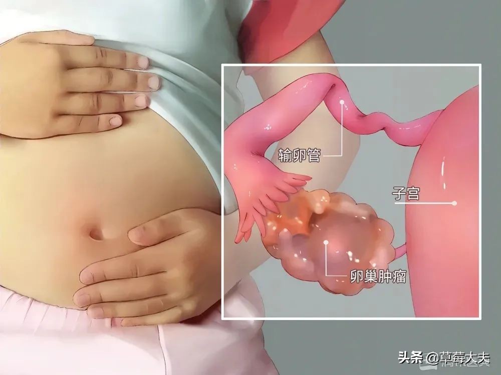 女孩腹痛难忍到医院,女童腹痛剧烈