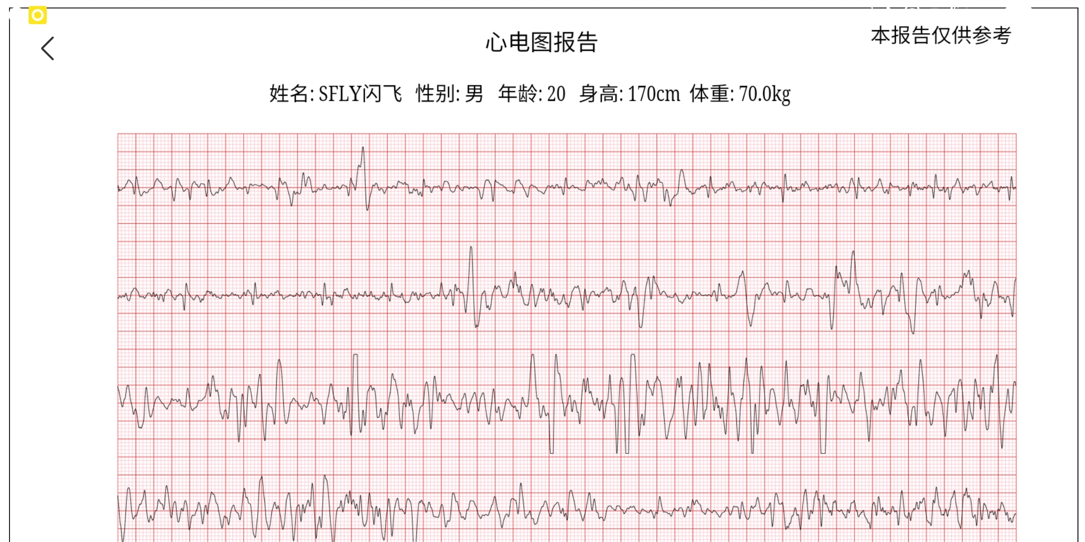 米家心电运动t恤重置方法,米家手表和手环