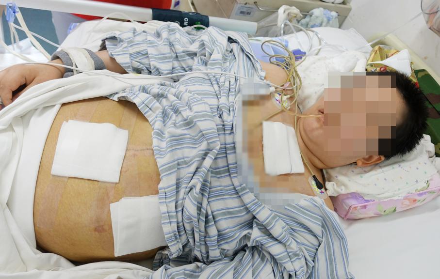 结核性脑积水,脑膜炎脑积水要治疗多久