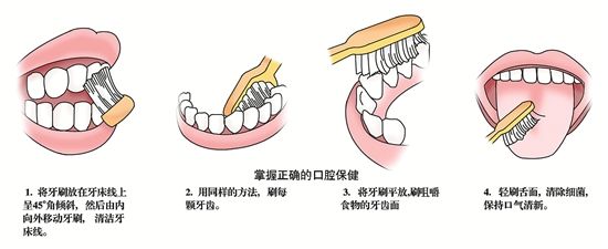 牙龈萎缩导致牙根酸痛怎么治疗,牙龈萎缩牙根腐烂怎么办