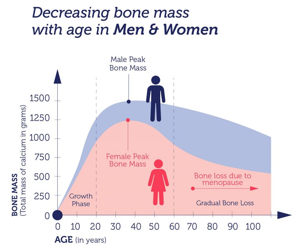 骨量减少需要吃骨质疏松药吗,诊断骨质疏松症只测定骨密度够吗