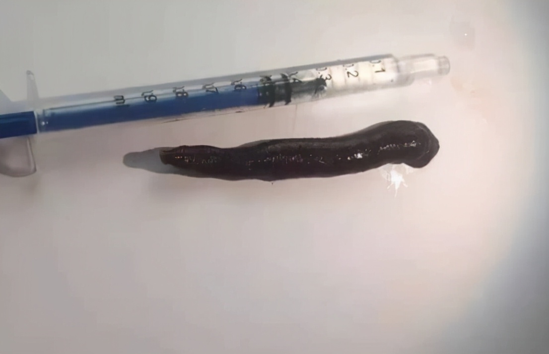 如果蚂蟥进入呼吸道能存活多久,蚂蟥寄生到体内多久能长大