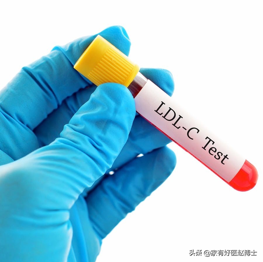 血脂血压尿酸都高如何治疗,血压血脂血糖尿酸哪个更严重