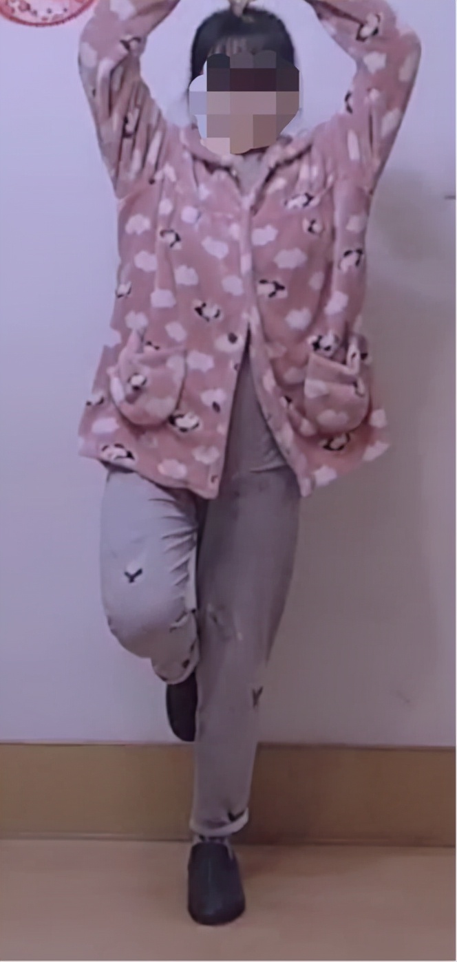 AI助力精准处理IV型髋关节发育不良花季少女翻开人生新篇章