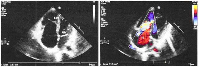 乙肝脸色发黄喝什么去黄,乙肝脸色发黄是怎么回事
