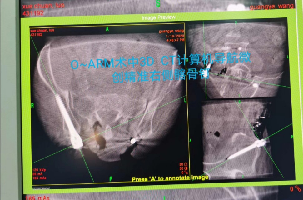 牙齿不好引发的疾病视频,牙齿有问题不做根管治疗会怎么样