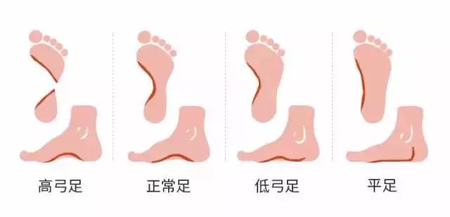 软木层鞋垫,适合脚感超软鞋子的鞋垫