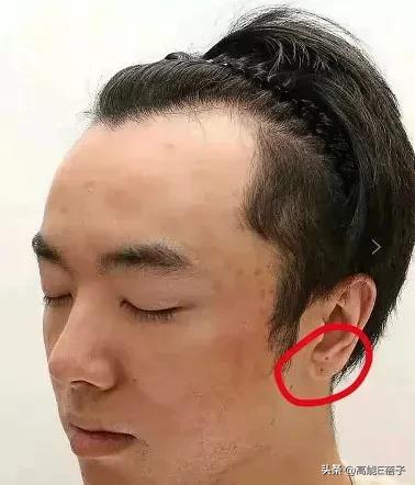 网友突然晒照曝华晨宇整容植发，还自称是其老婆，被张碧晨介入？