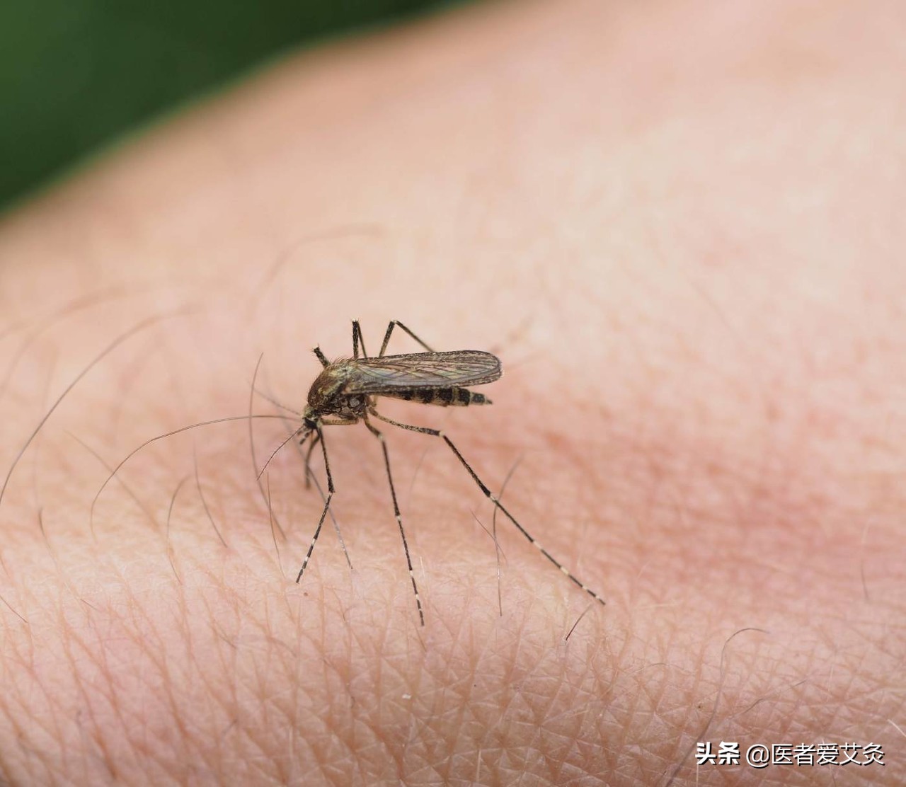 皮肤瘙痒耳朵也瘙痒是怎么回事,耳朵止痒最灵的土方法